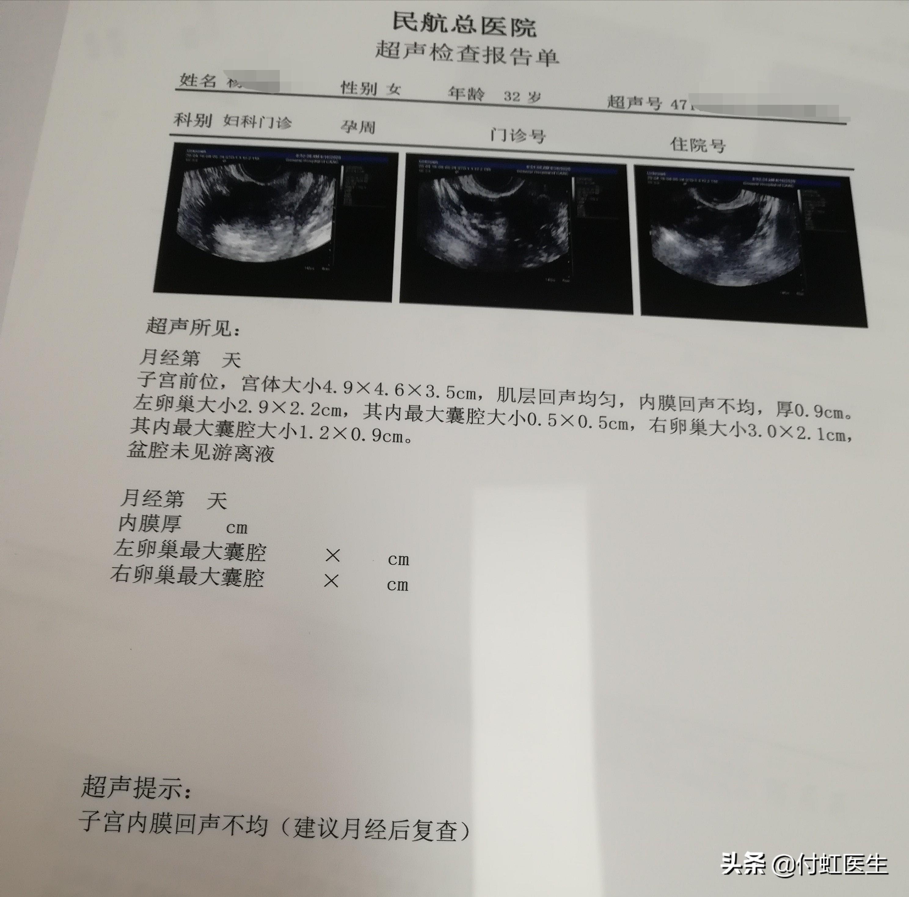 最新B超單，解讀孕期胎兒健康狀況的關(guān)鍵所在